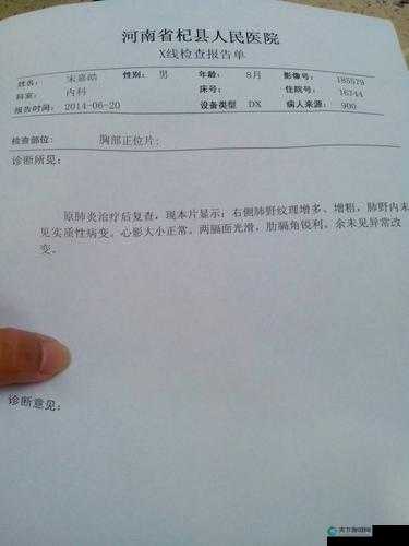 胸片 100 曝光愤怒软件：引发众怒背后的真相探寻