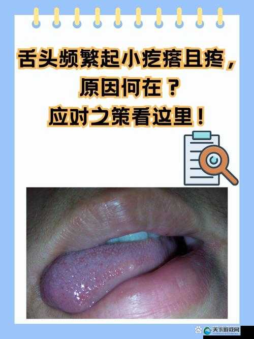 舌头舔到硬物包疼痛难忍，究竟是何原因引发