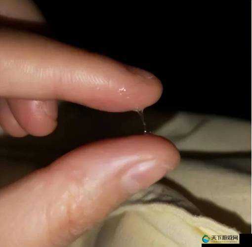 一动下面就有水一样的分泌物究竟为何会出现这种情况