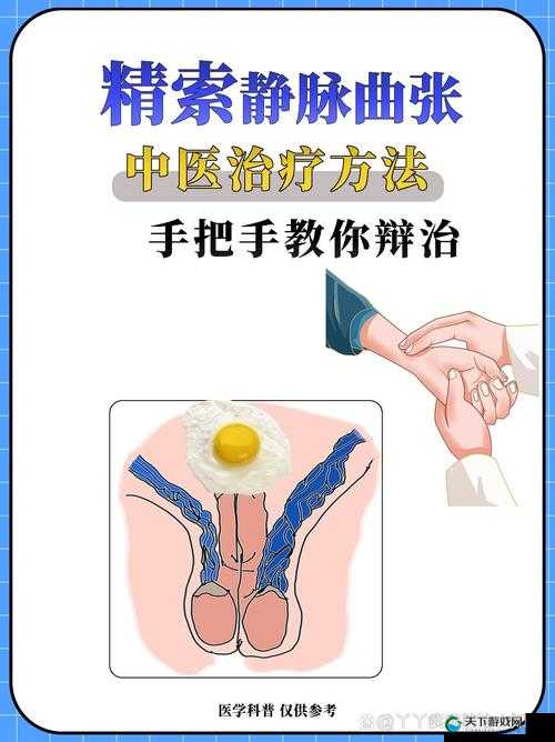 胡桃夹精索静脉曲张能治好吗：名医在线解读治疗方法