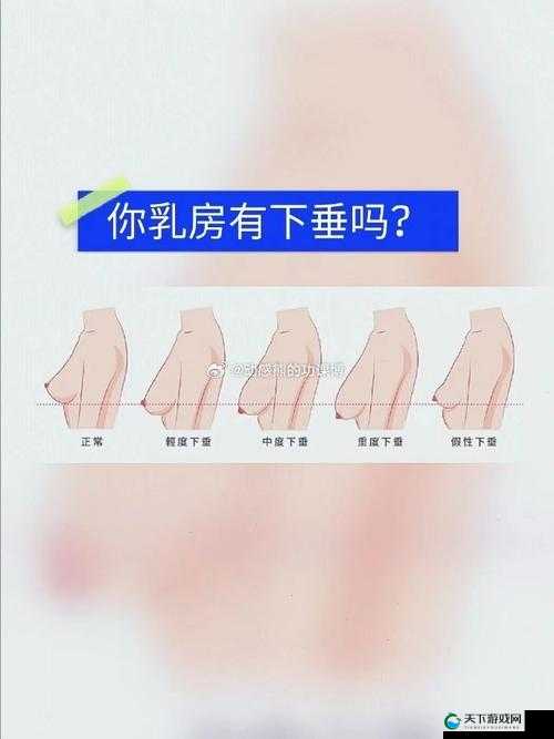 20 岁少女胸软又下垂，这正常吗？