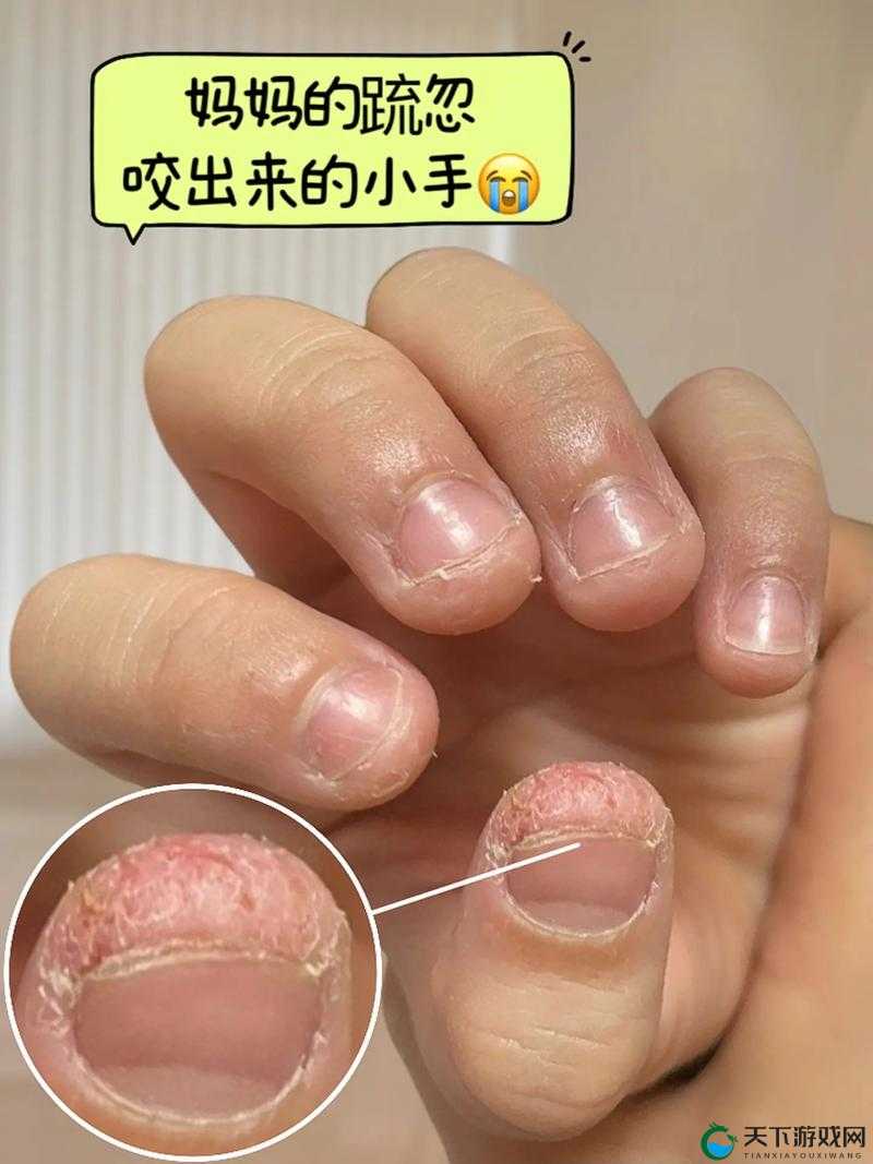 为什么手指会划入缝隙挖水背后的原因探究
