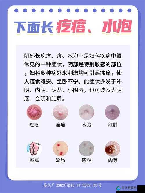 女生私密部位起痘该如何有效治疗