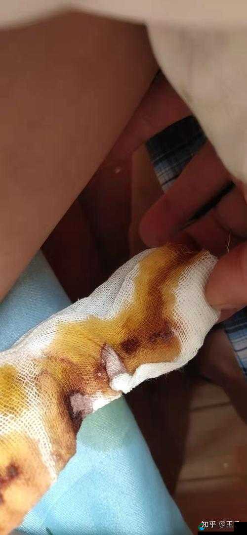 男人割了皮包什么样子要手举着呢：详细解析与注意事项