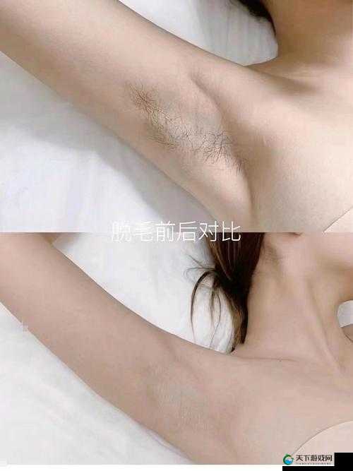 肥婆的黑毛：揭示毛茸茸的秘密