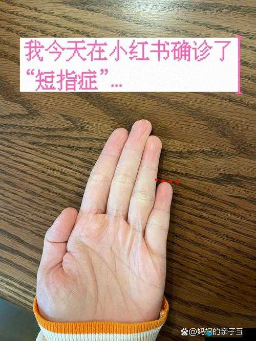 年经继拇是免费的吗：其相关情况究竟如何