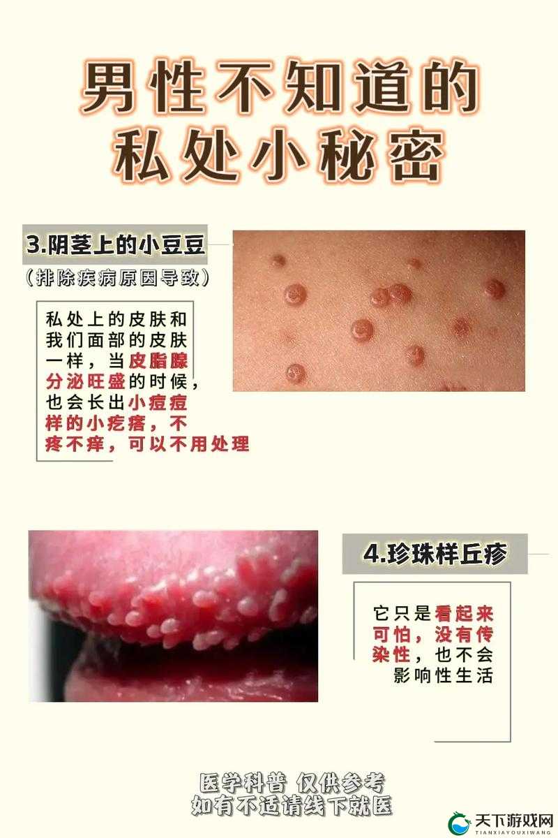 小阴囊唇一边大一边小能自己好吗：这是正常现象还是需要就医呢