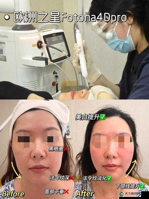 欧洲之星 4D 做一次效果怎么样:深度解析与真实体验分享