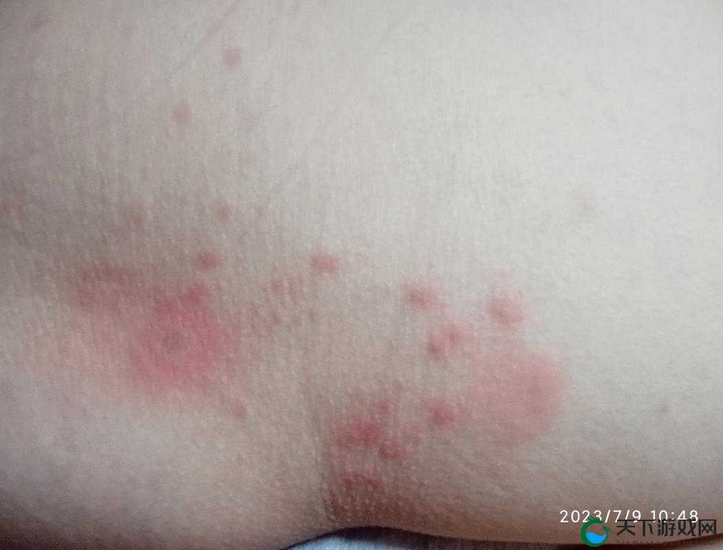 才一颗葡萄就疼成这样简介:探究背后的惊人原因