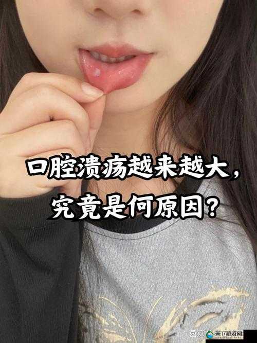 上下两张嘴都肿了:是何原因导致?