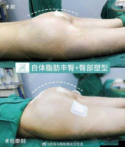 蜜桃丰臀 mt123：关于它的详细介绍与特点分析