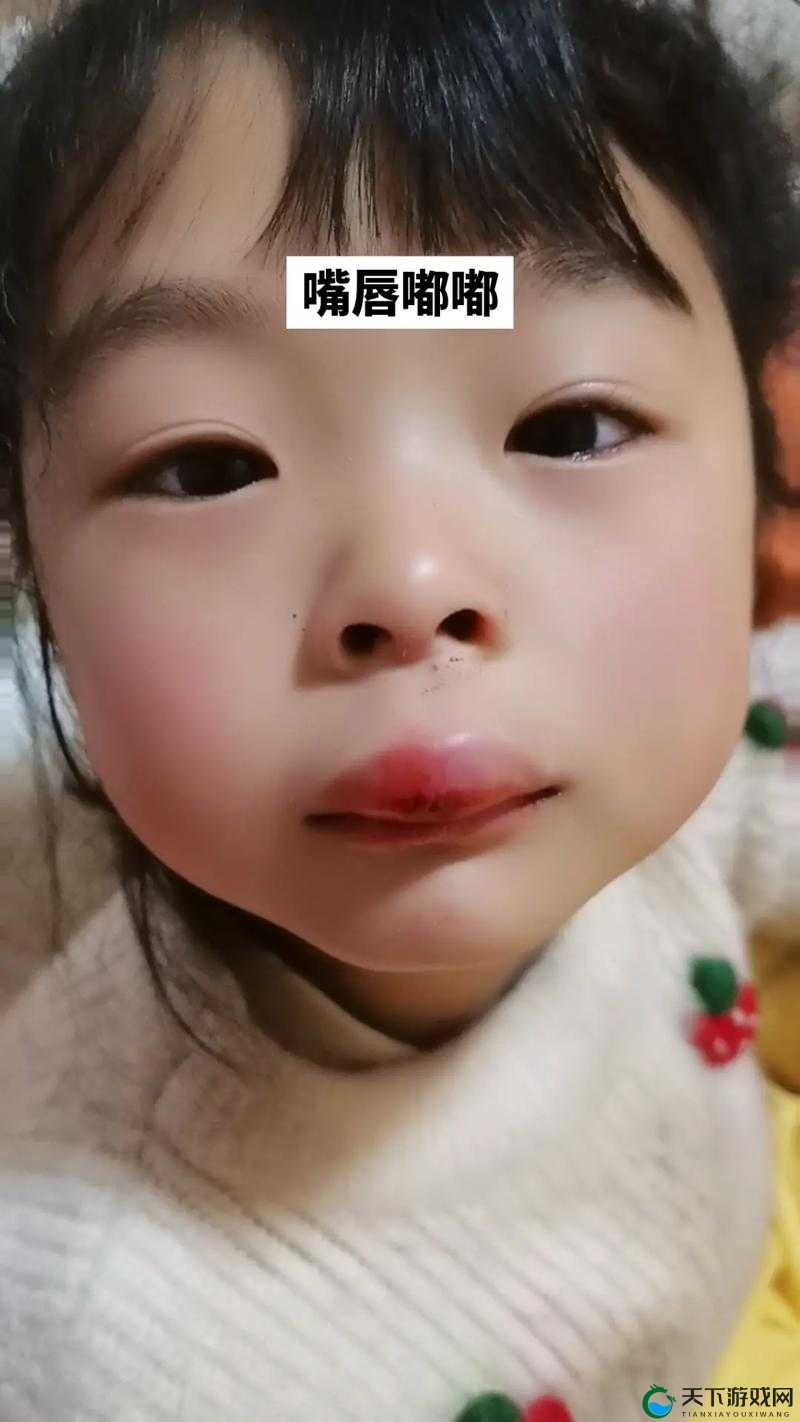 塞满嘴巴把脸撑大了能恢复吗:面部肿胀的解决方法
