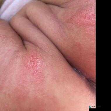 宝宝下面都湿透了还嘴硬疼咋回：探寻背后的原因和解决办法