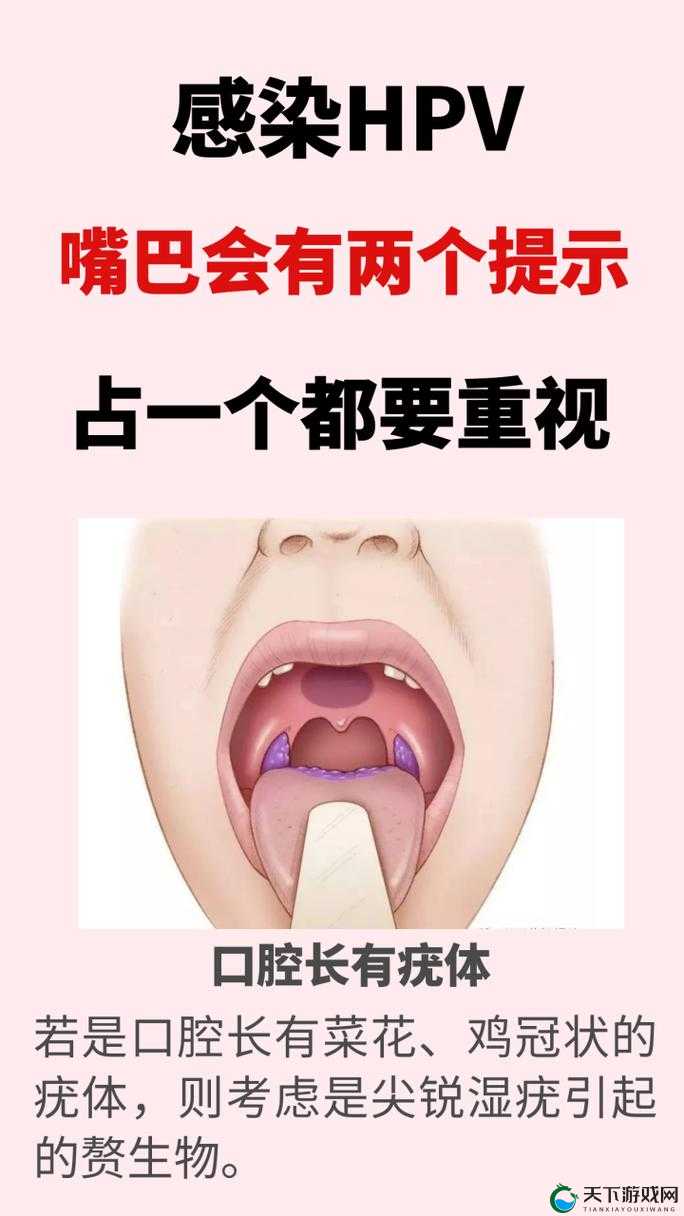 女的用嘴巴吃鸡会得 HPV 即将上市相关信息解读