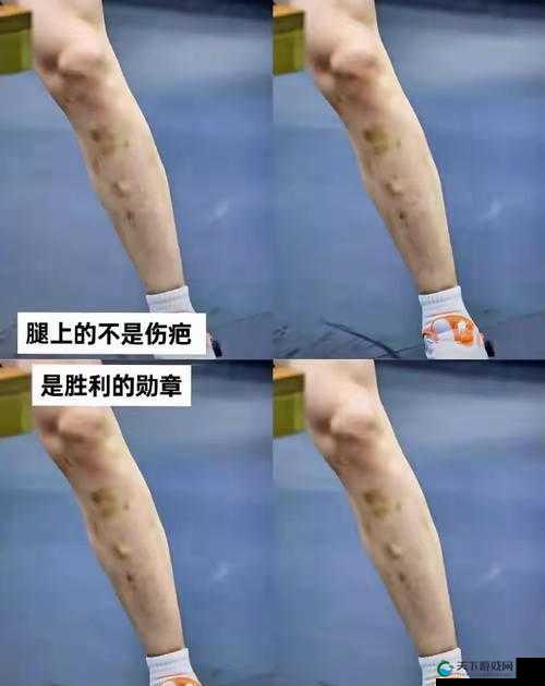 快顶不住了刺射腿上：探寻这一惊人举动背后的真相