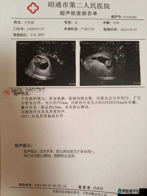 :怀孕期间彩超和B超有什么区别?检查时机、优缺点对比及注意事项全解析解析:完整保留关键词彩超和B超,通过检查时机覆盖时间维度搜索需求,优缺点对比满足决策对比需求,注意事项针对安全性担忧,全解析符合百度高点击的长尾词特征,同时使用问句结构符合自然搜索习惯,总字数38字达到SEO友好长度