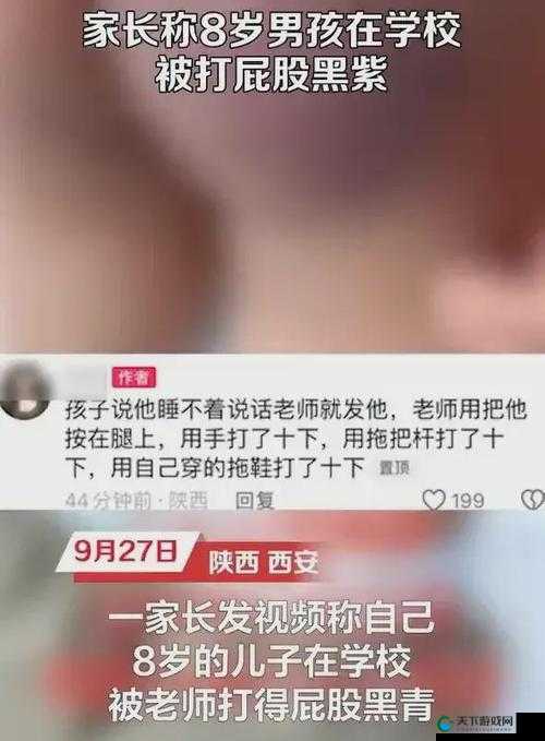 被主人惩罚打肿臀缝是怎么回事?为何会出现这种情况?深度解析背后原因