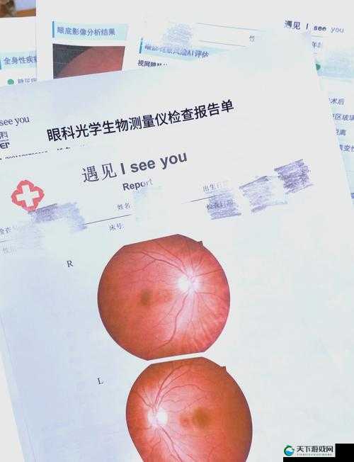 女生如何正确将疾子放入定眼?详细步骤与注意事项分享