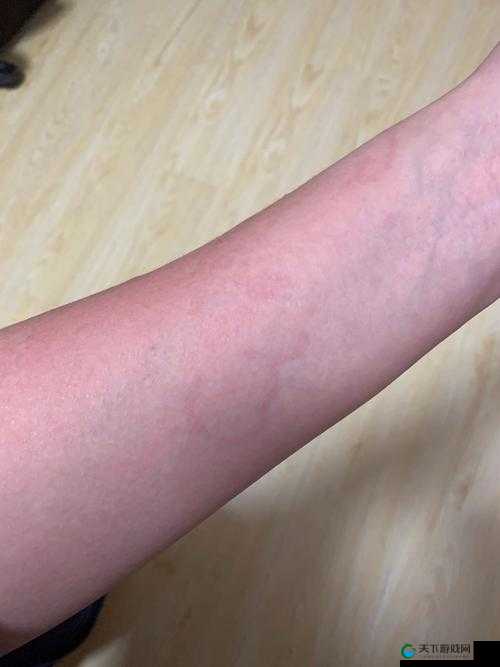 Free⭕⭕⭕⭕XXXX 为何会出现偷窥现象？背后原因究竟是什么？