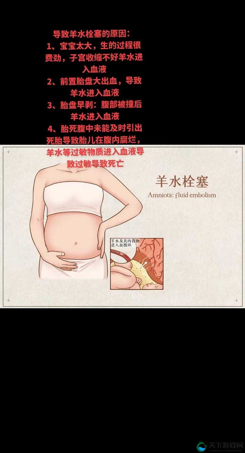 羊水栓塞是一种罕见但极其危险的分娩并发症，其正确的急救方法是怎样的呢？